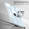 FINTIE Coque Compatible avec MacBook Air 13.6 Pouces M5 M4 M3 M2 (2026/2025/2024/2022, A3449/A3240/A3113/A2681), Coque Fine Légè
